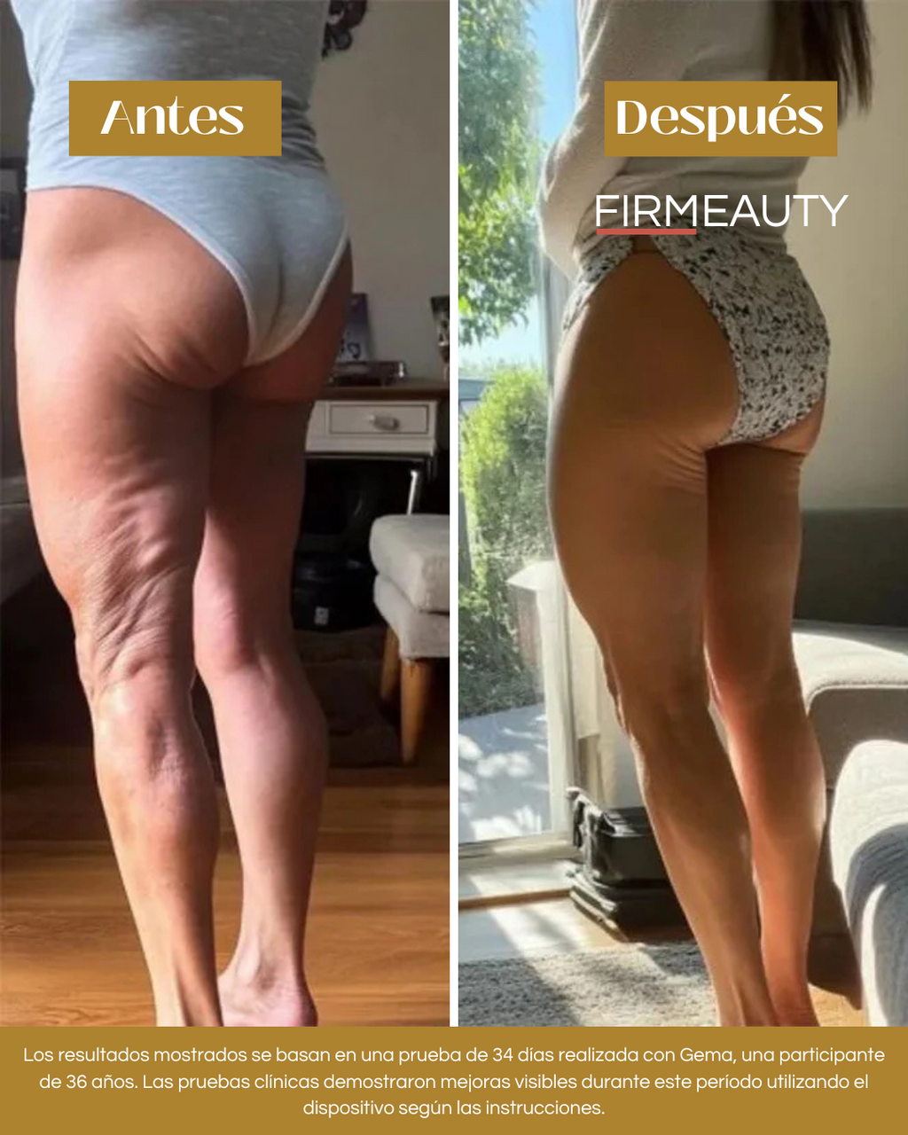 Firmeauty™ Kit Reductor de Celulitis