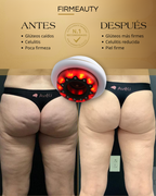 Firmeauty™ Kit Masajeador Scraping para Celulitis y Lipedema