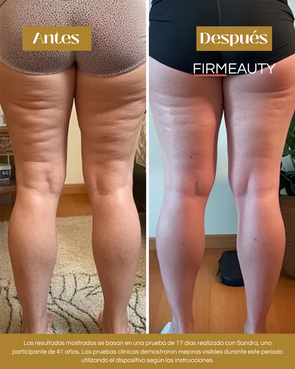 Firmeauty™ Kit Reductor de Celulitis
