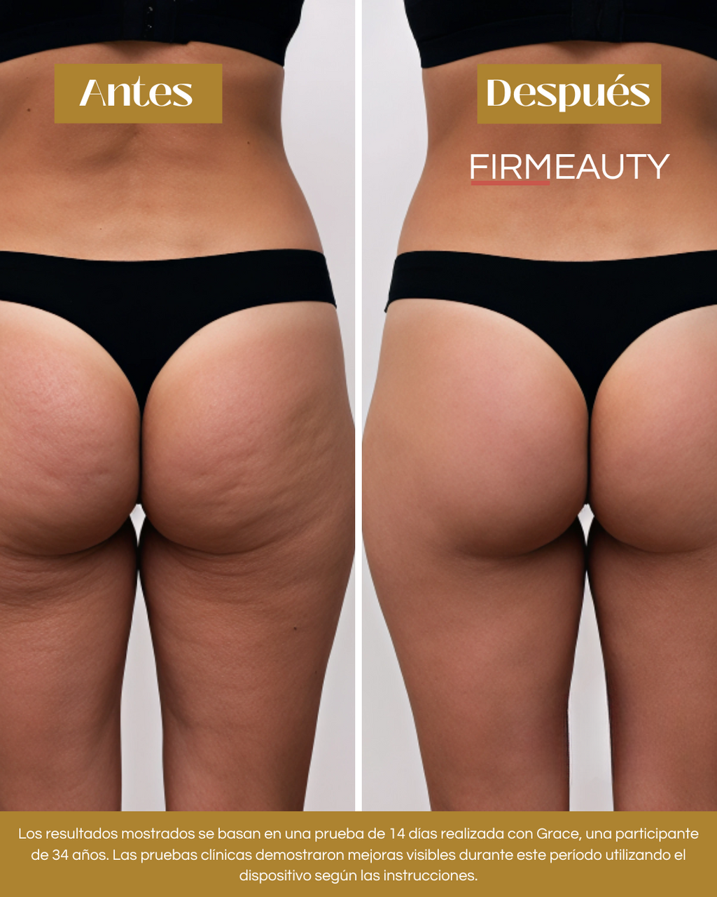 Firmeauty™ Kit Reductor de Celulitis