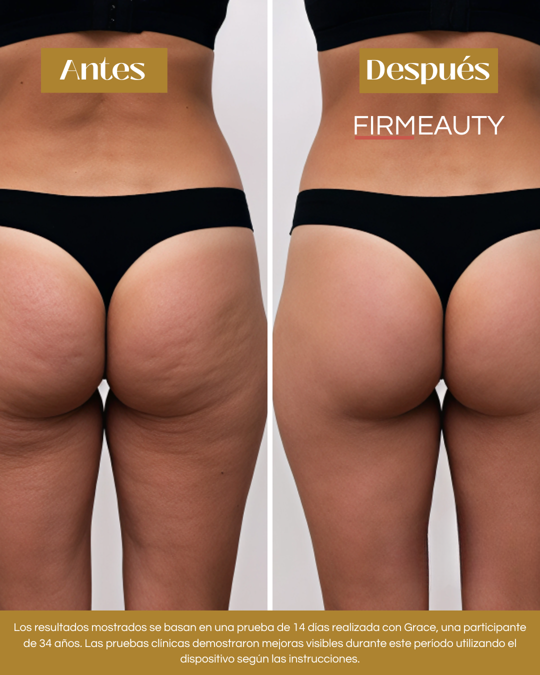 Firmeauty™ Kit Reductor de Celulitis