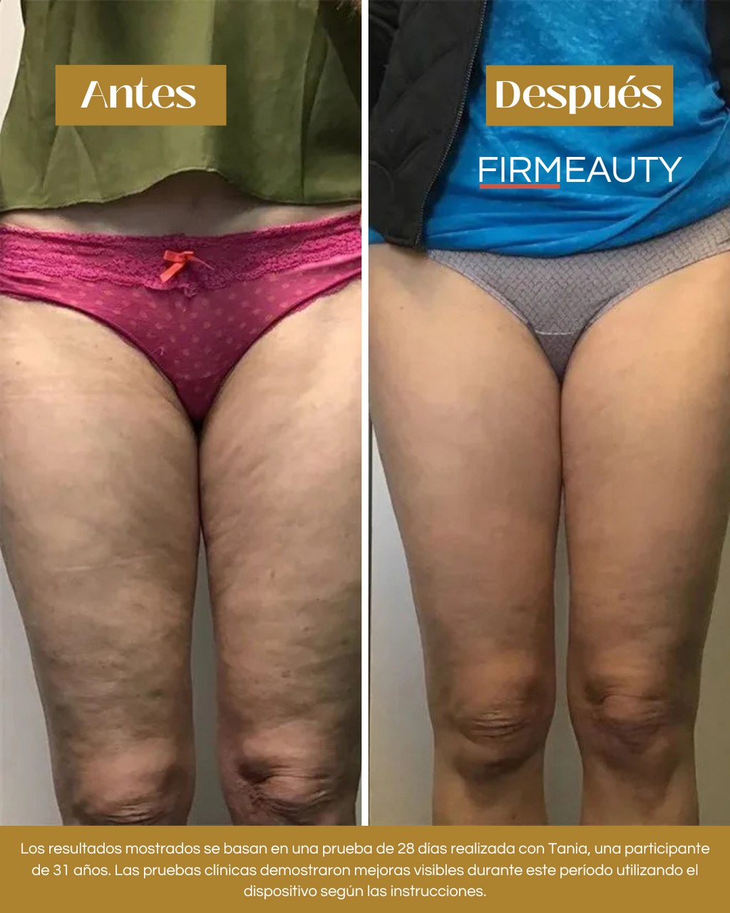 Firmeauty™ Kit Reductor de Celulitis