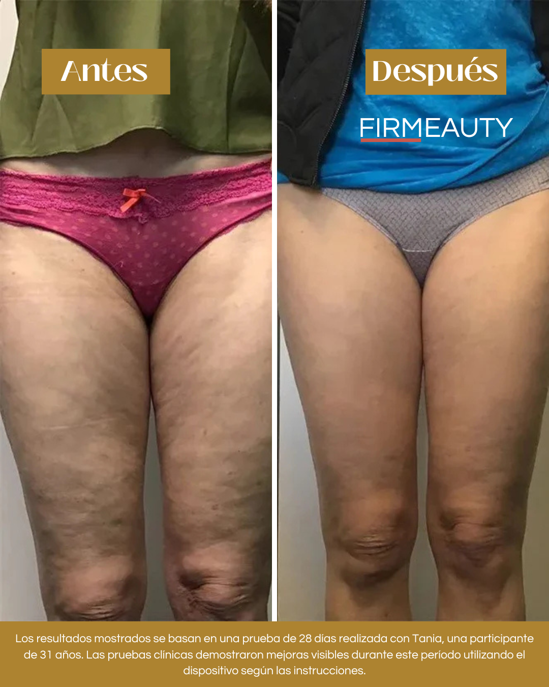 Firmeauty™ Kit Reductor de Celulitis